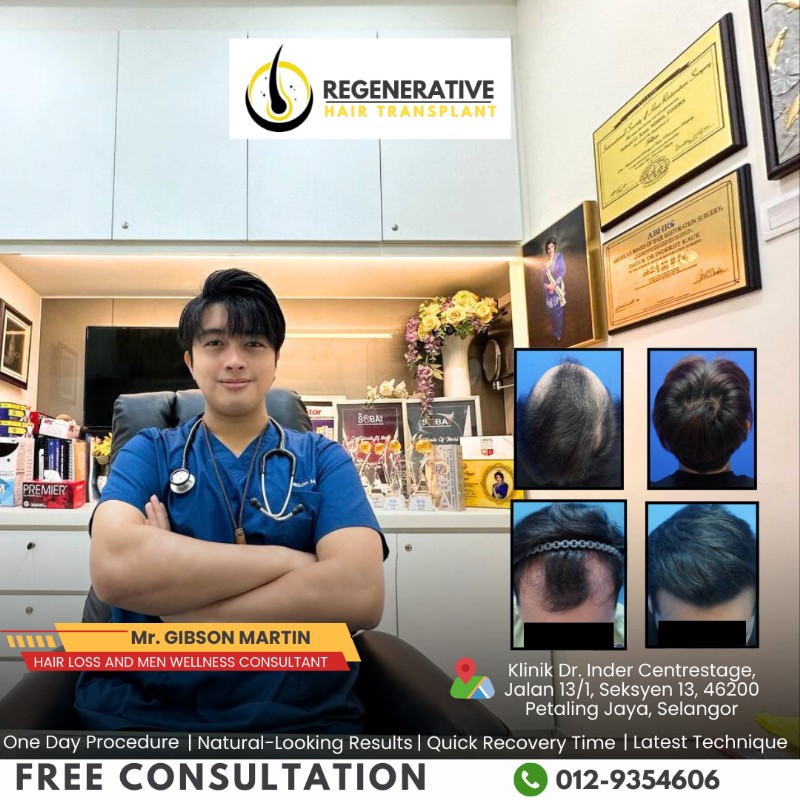 Gibson - Hair Loss Consultant
